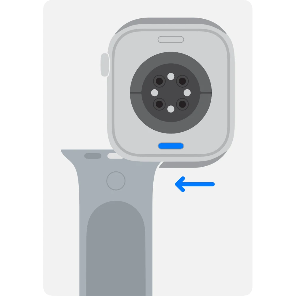 רצועה APPLE WATCH